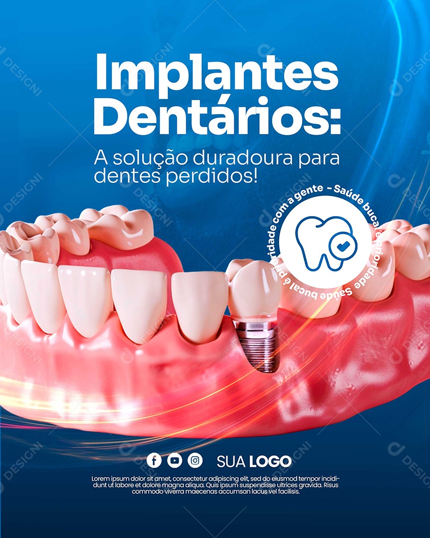 Dentista Implantes Dentários Social Media PSD Editáve