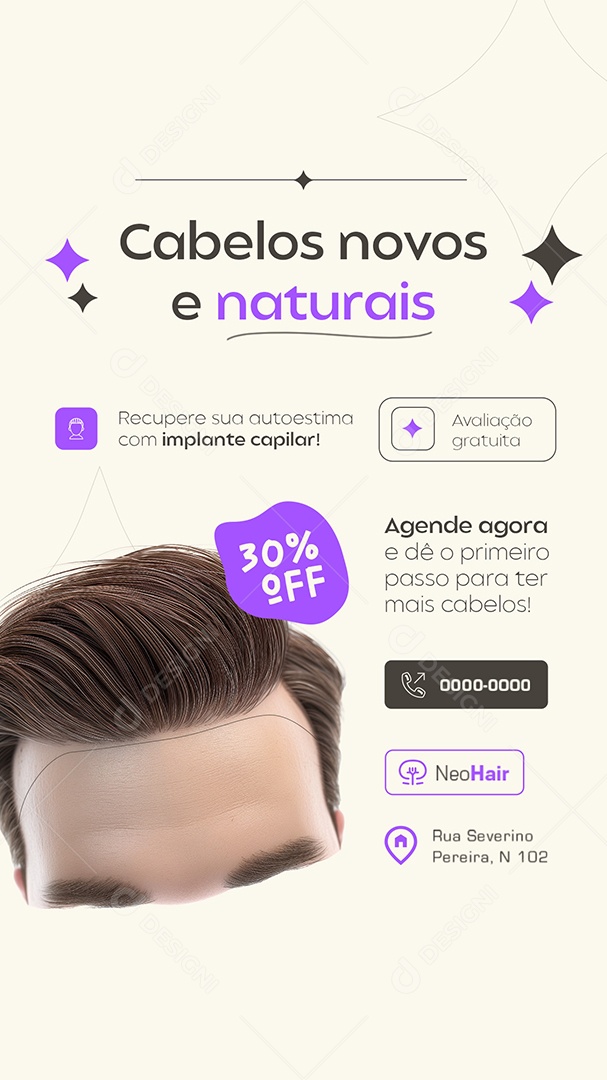 Story Implante Capilar Cabelos Novos e Naturais Social Media PSD Editável