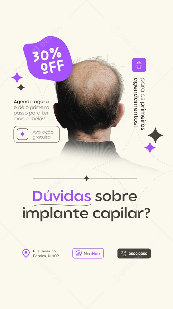 Story Dúvidas Sobre Implante Capilar Social Media PSD Editável