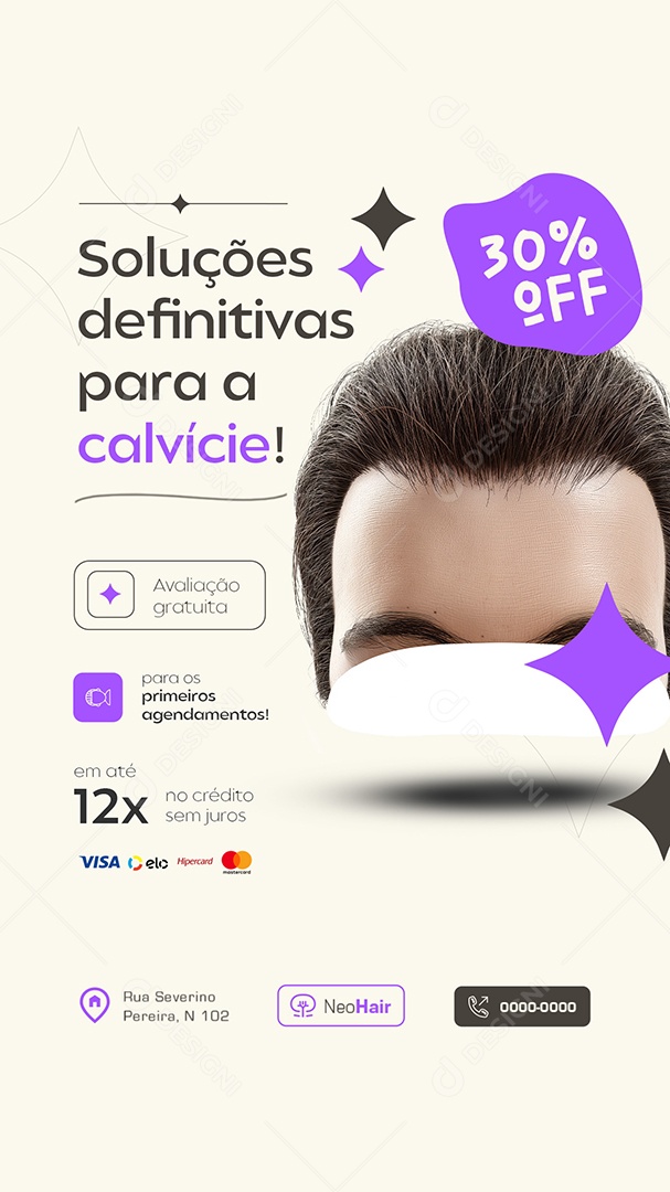 Story Implante Capilar Soluções Definitivas Social Media PSD Editável