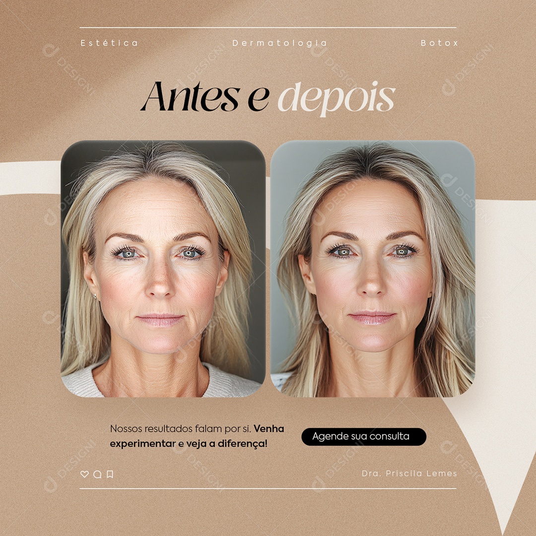 Estética Antes e Depois Social Media PSD Editável