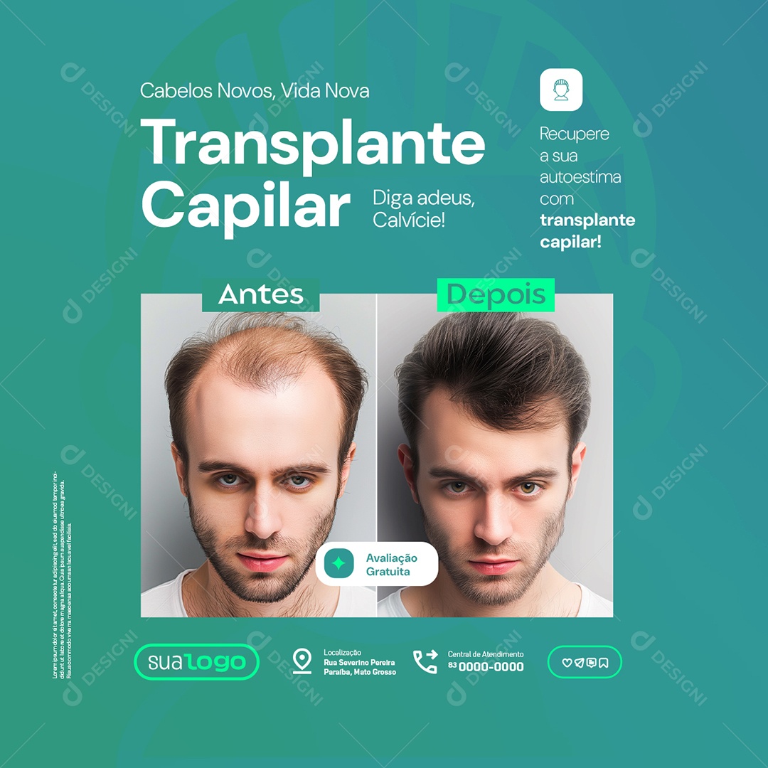 Transplante Capilar Cabelos Novos Vida Nova Social Media PSD Editável