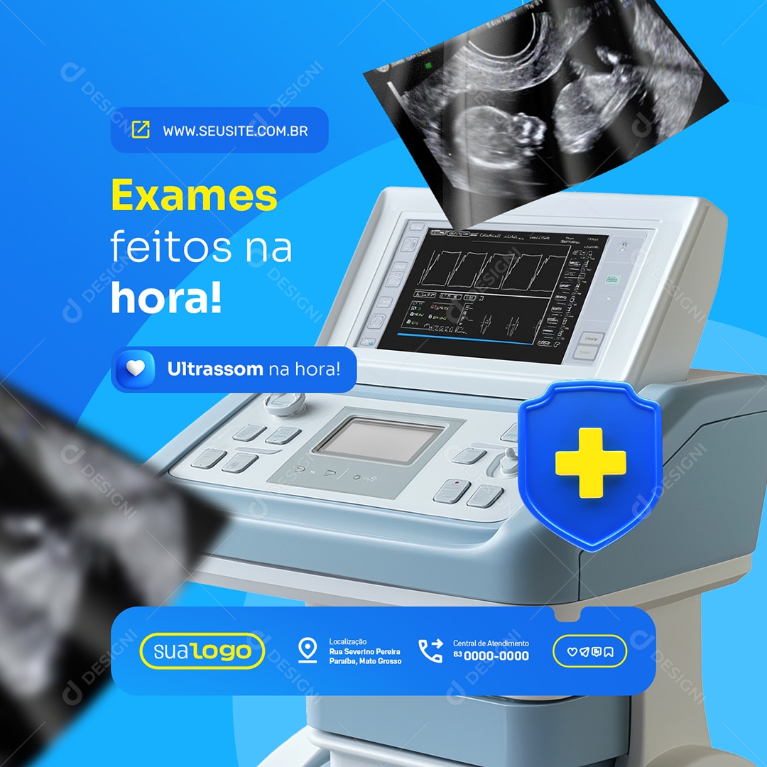 Clinica Hospitalar Exames Feitos na Hora Social Media PSD Editável