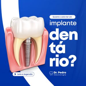 Pack Coleção de 