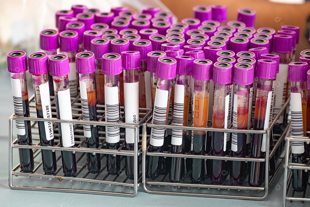 Tubos de amostra de sangue de um doador de sangue