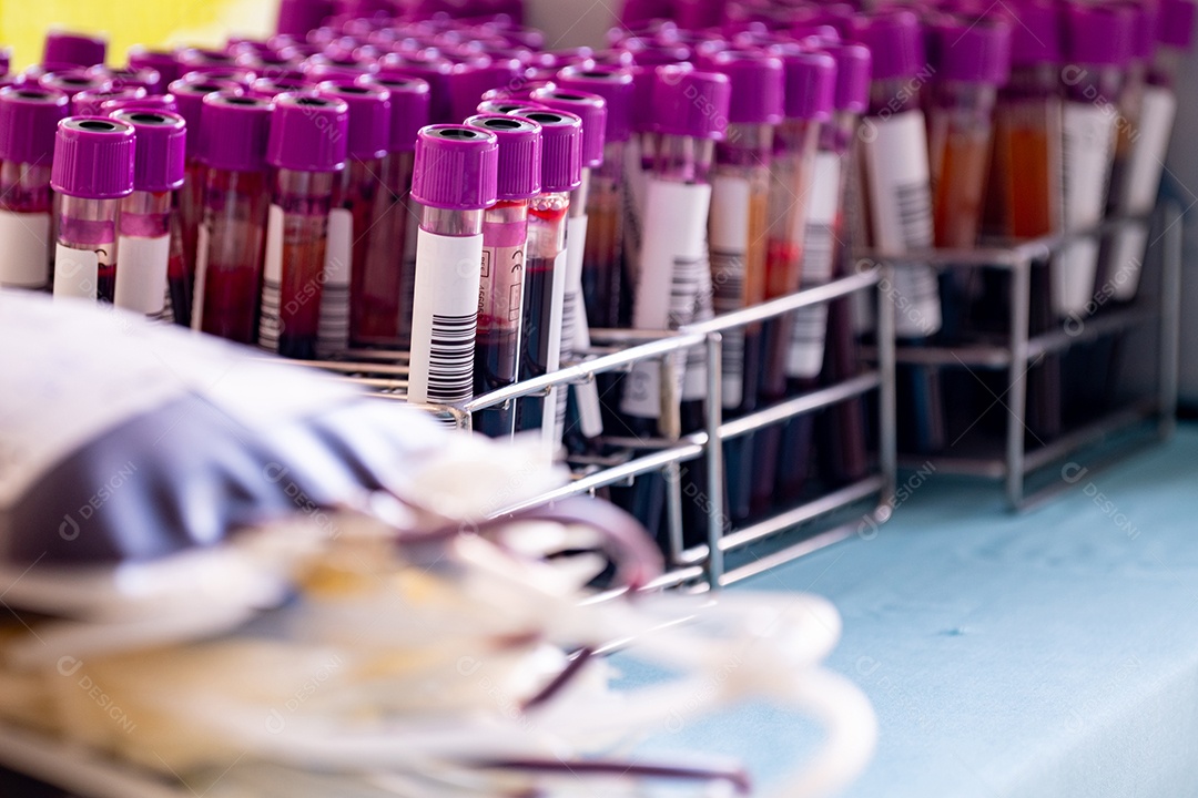 Close up e foco seletivo de um grupo de tubos de amostra de sangue de um doador de sangue