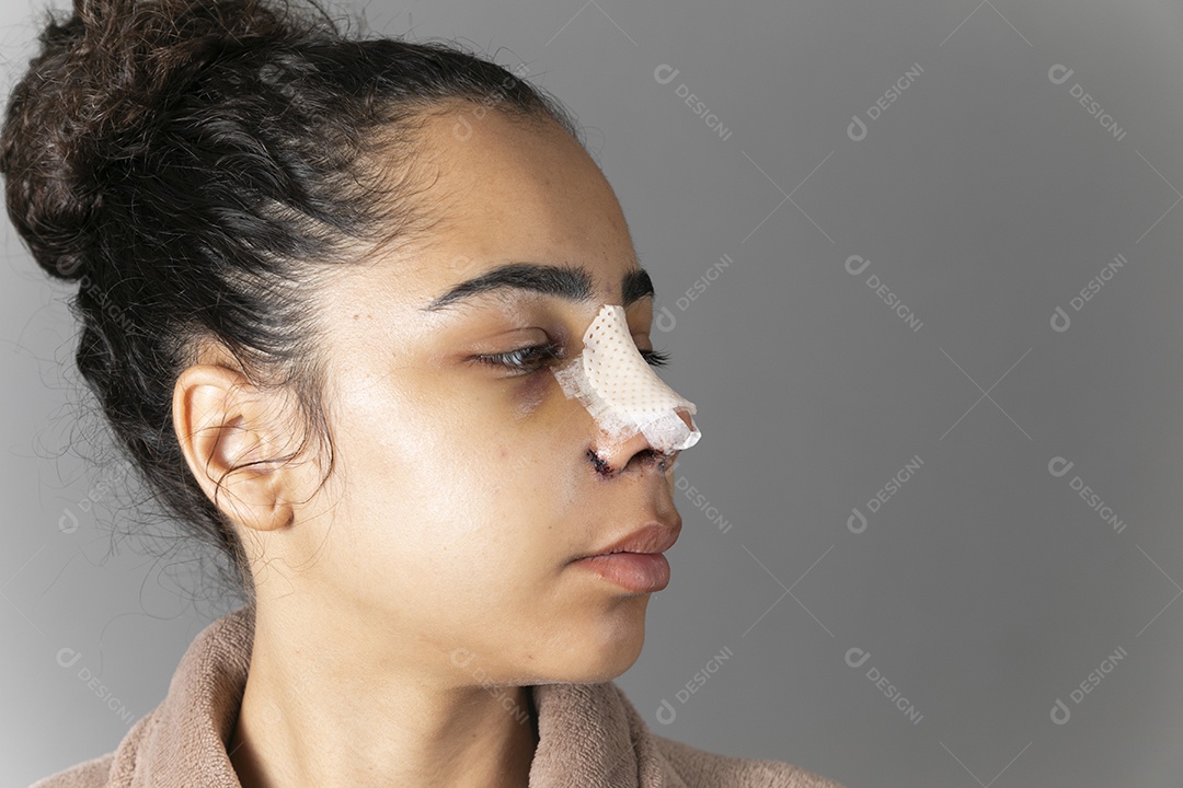 Mulher com nariz enfaixado