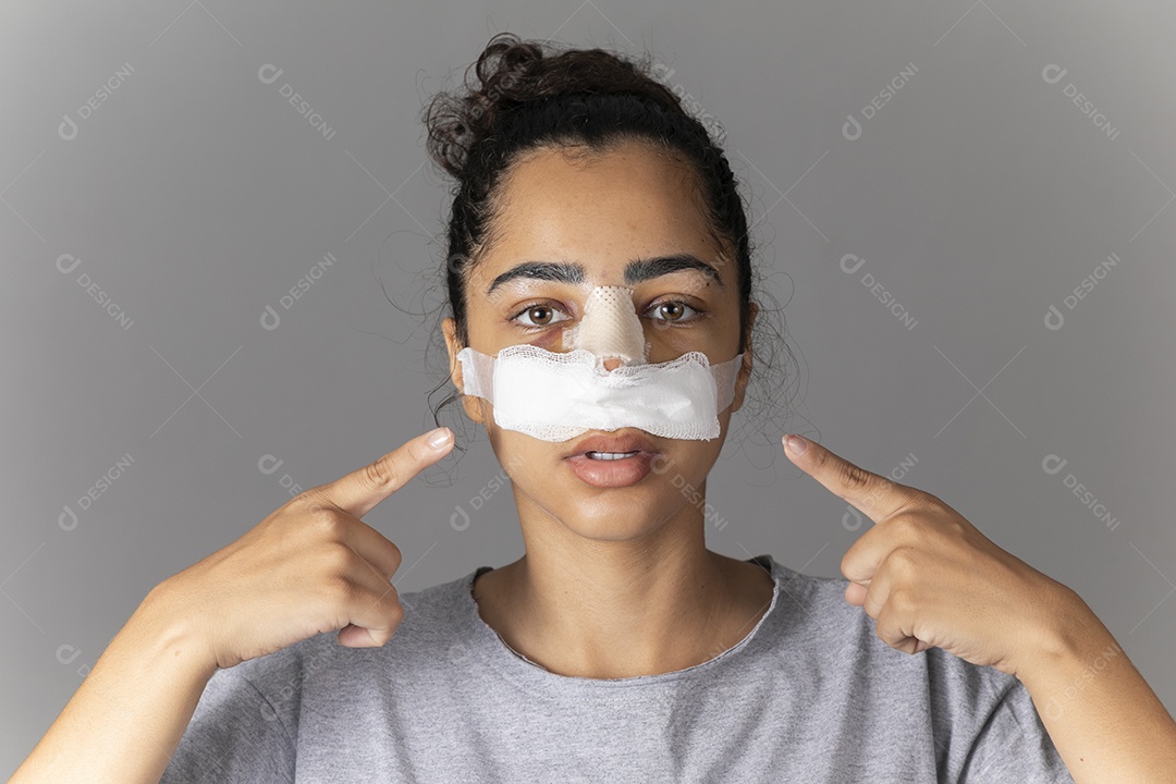 Mulher com curativo no nariz apontando para o rosto