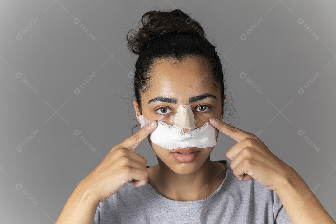 Mulher apontando para o olho com curativo no nariz