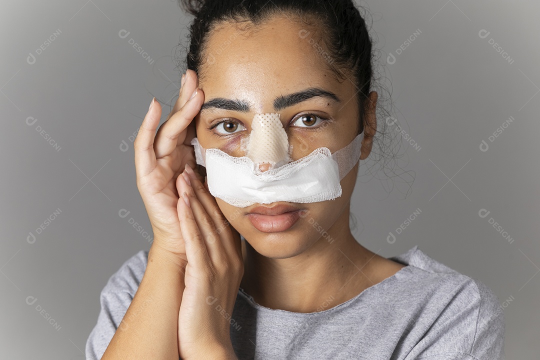 Mulher com mãos no rosto e curativo no nariz