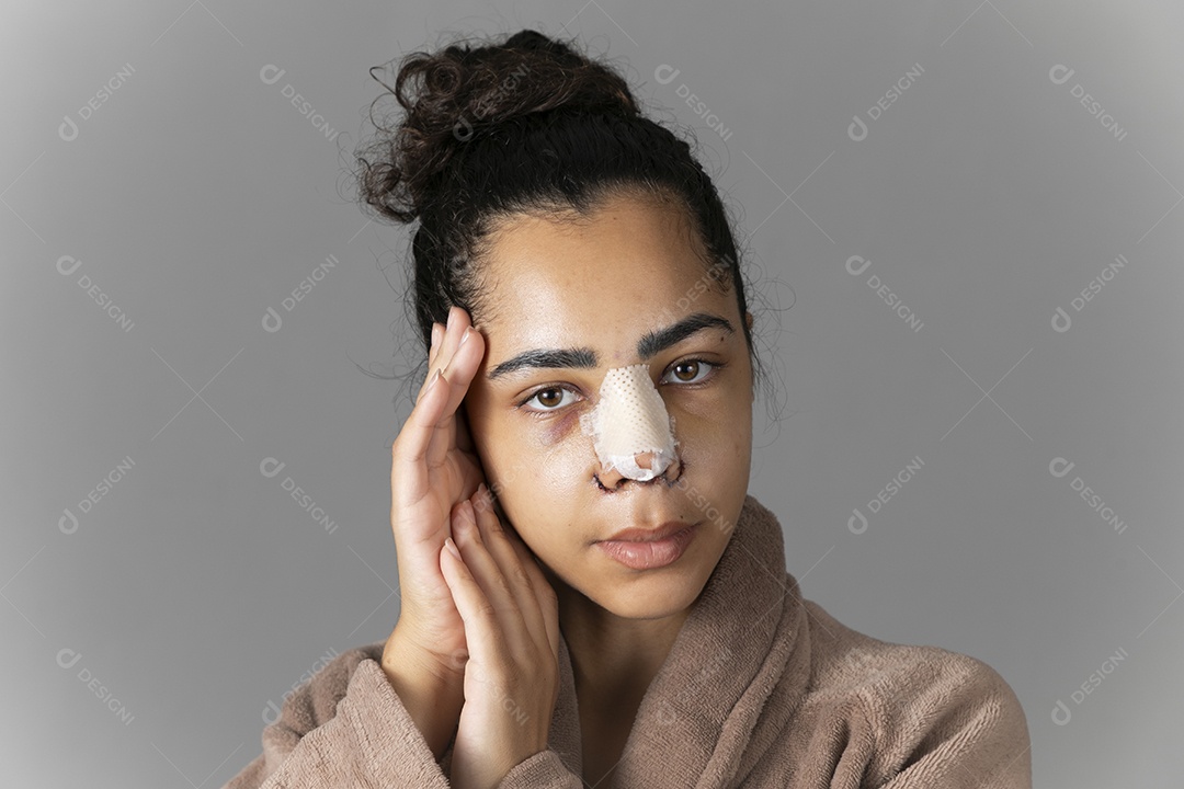 Mulher com mãos no rosto e nariz feito cirurgia