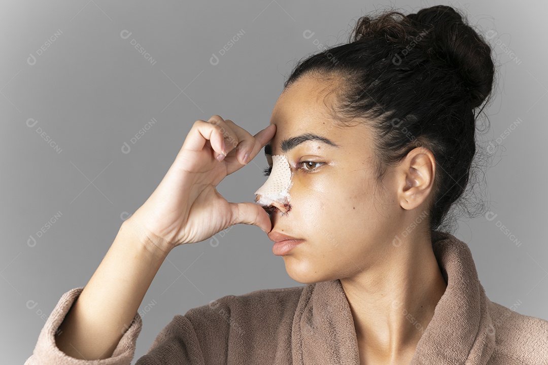 Mulher com mãos no nariz mostrando cirurgia