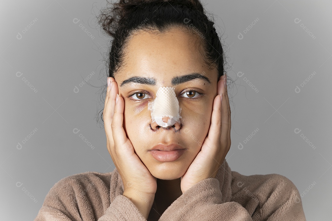 Mulher com mãos no rosto e nariz enfaixado