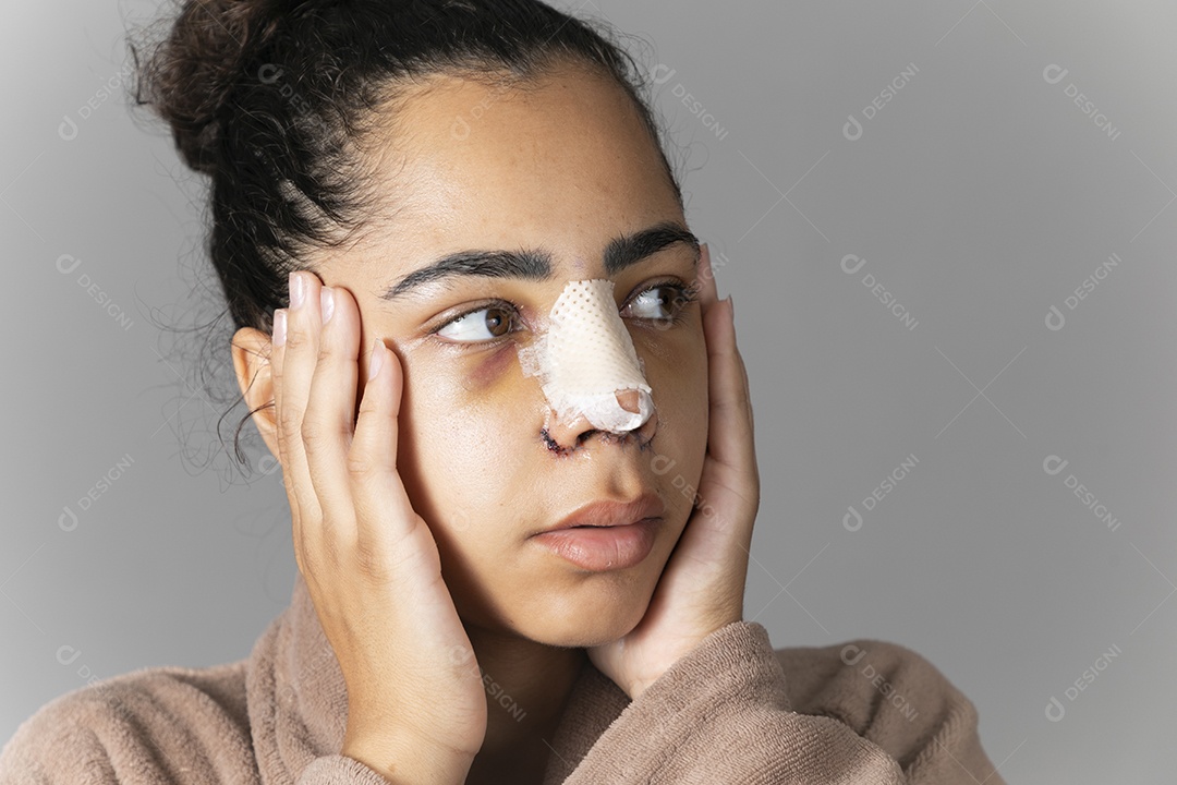 Jovem com mãos no rosto e nariz enfaixado