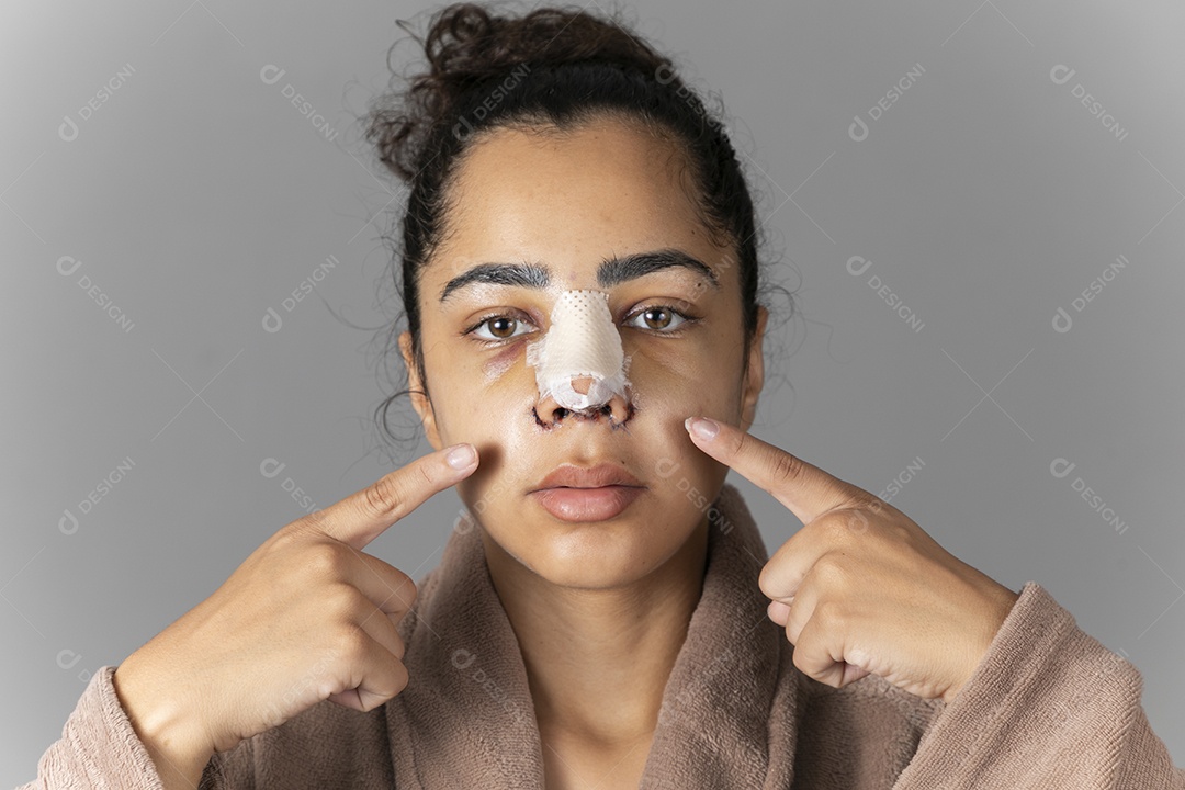 Mulher apontando para o seu nariz feito cirurgia