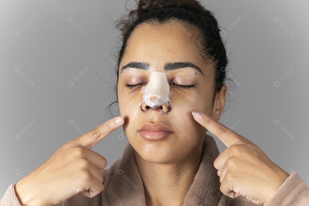 Mulher apontando para o seu nariz feito cirurgia