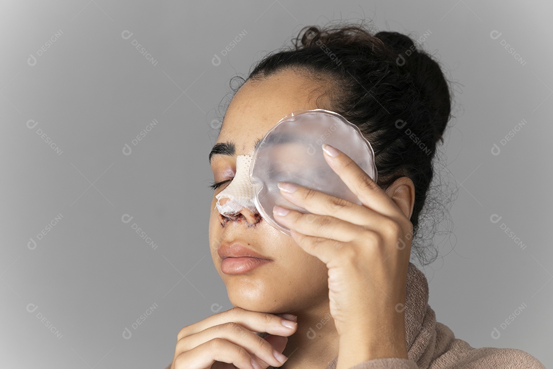 Mulher com nariz feito rinoplastia e bolsa de gelo no rosto