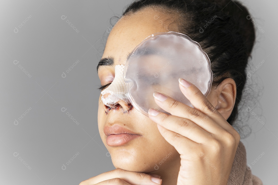 Mulher com bolsa de gelo no rosto