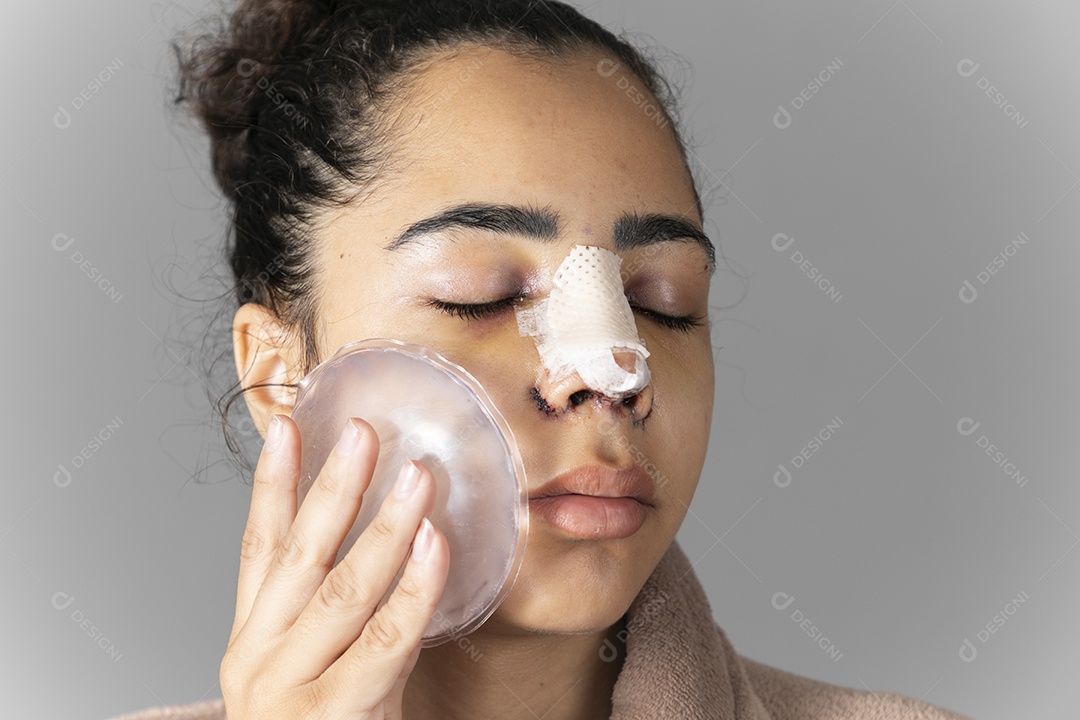 Mulher com bolsa de gelo no rosto