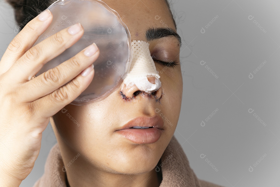 Mulher com bolsa de gelo no olho depois de uma cirurgia