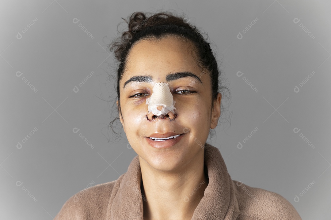 Mulher sorrindo depois de cirurgia de rinoplastia