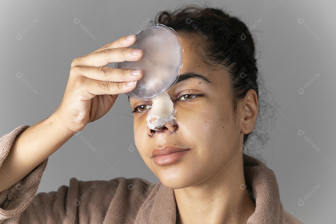 Jovem moça com bolsa de gelo no rosto