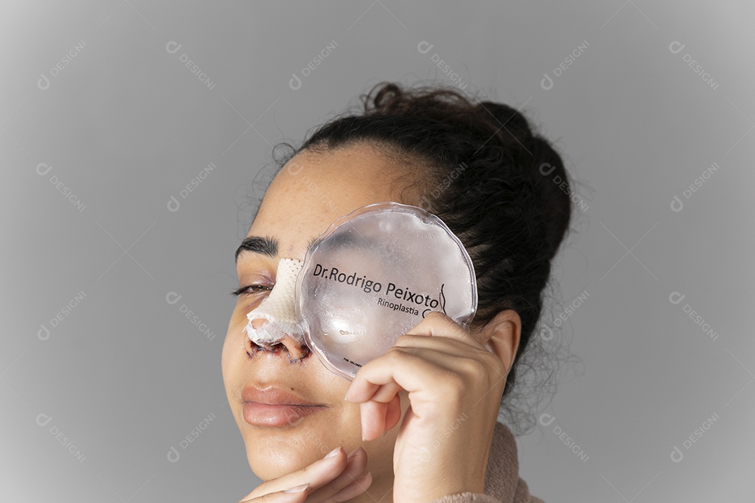 Mulher com bolsa de gelo no rosto depois de uma cirurgia