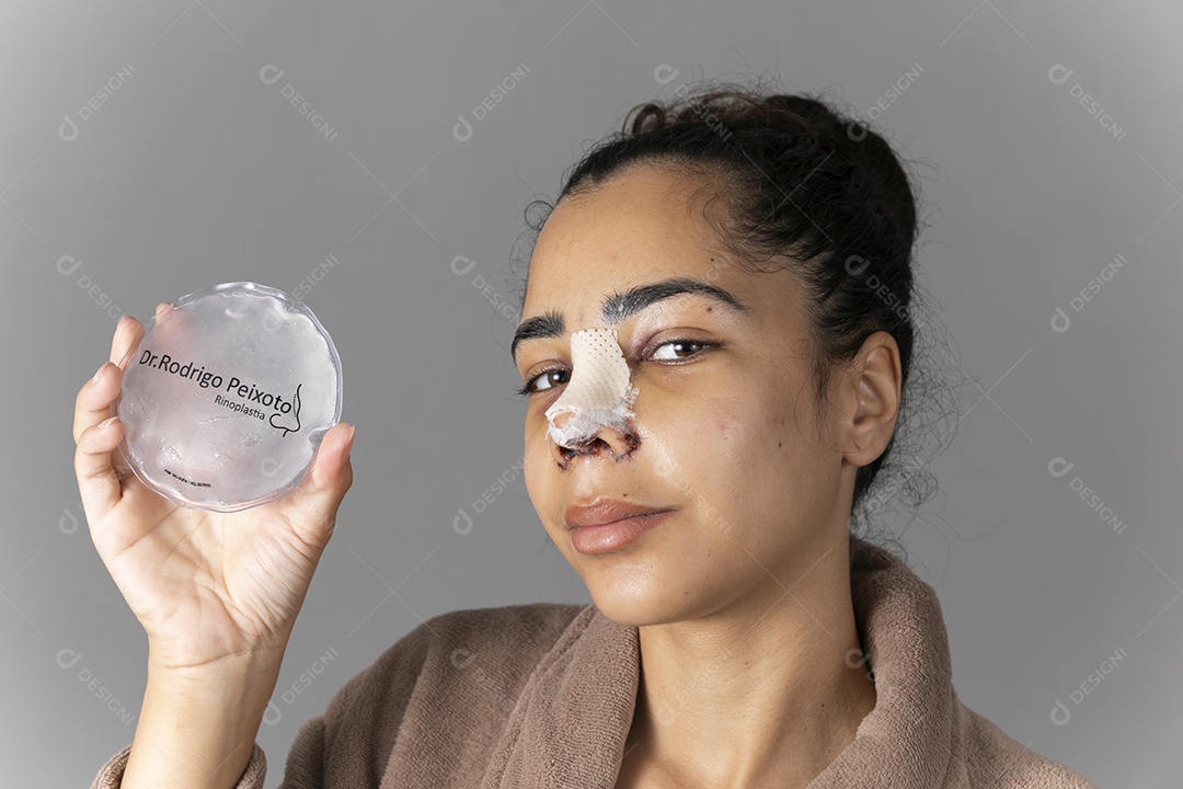 Mulher com cirurgia no nariz e bolsa de gelo na mão