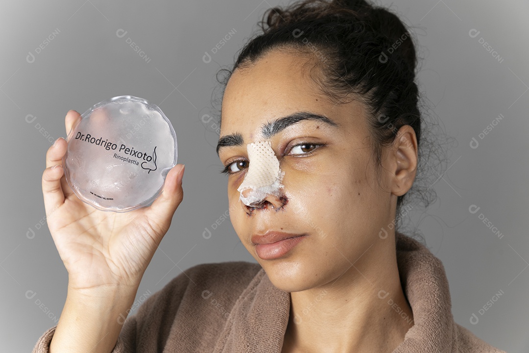 Mulher com bolsa de gelo na mão para colocar no nariz