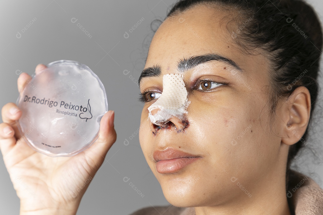 Mulher com bolsa de gelo para colocar no nariz depois de cirurgia