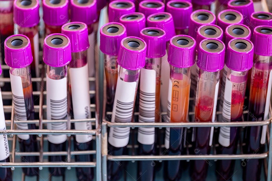 Close up de um grupo de tubos de amostra de sangue de um doador de sangue