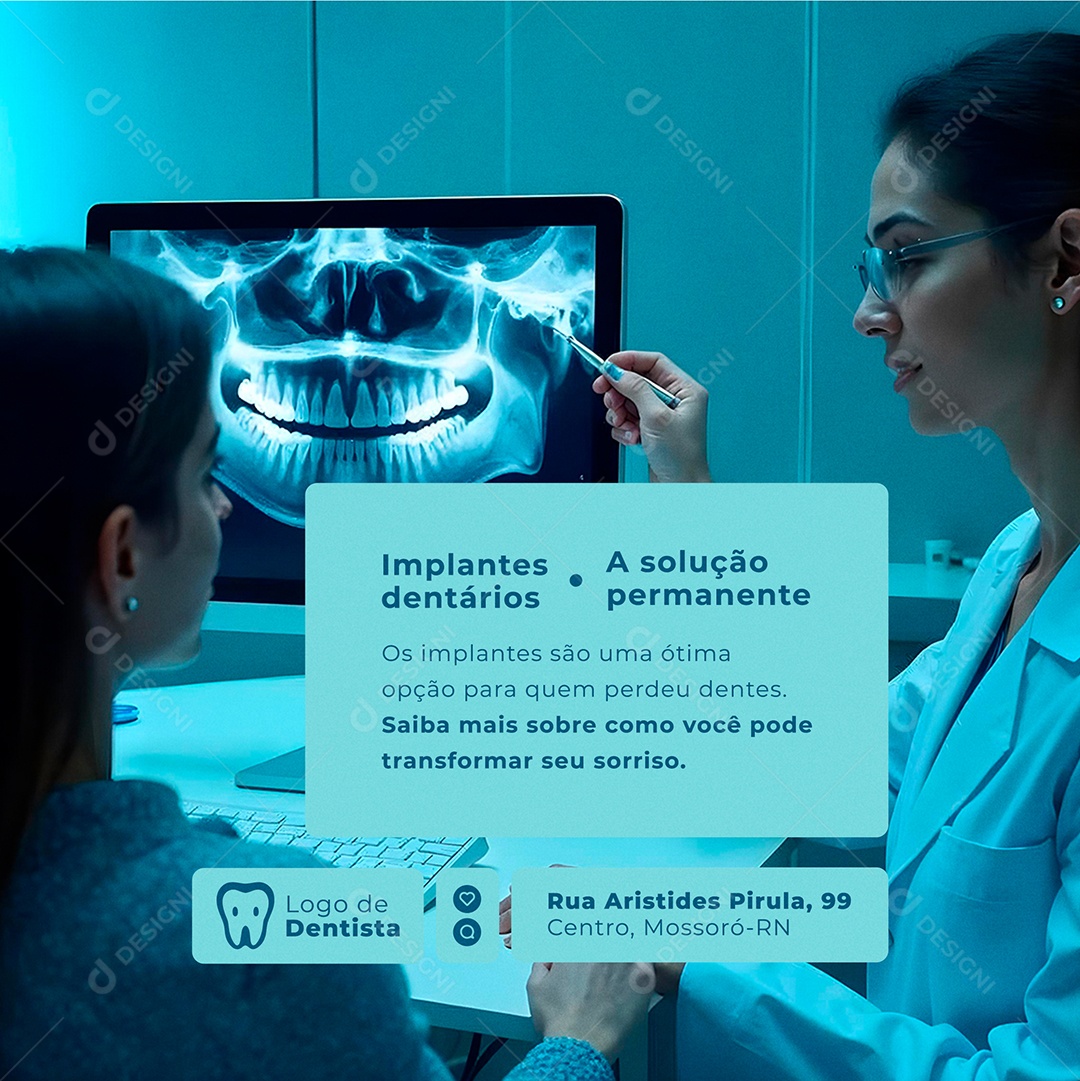 Dentista Implantes Dentários Social Media PSD Editável