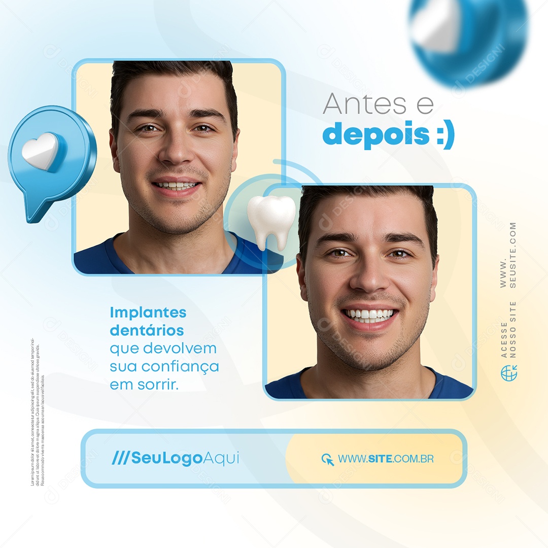 Odonto Antes e Depois Social Media PSD Editável