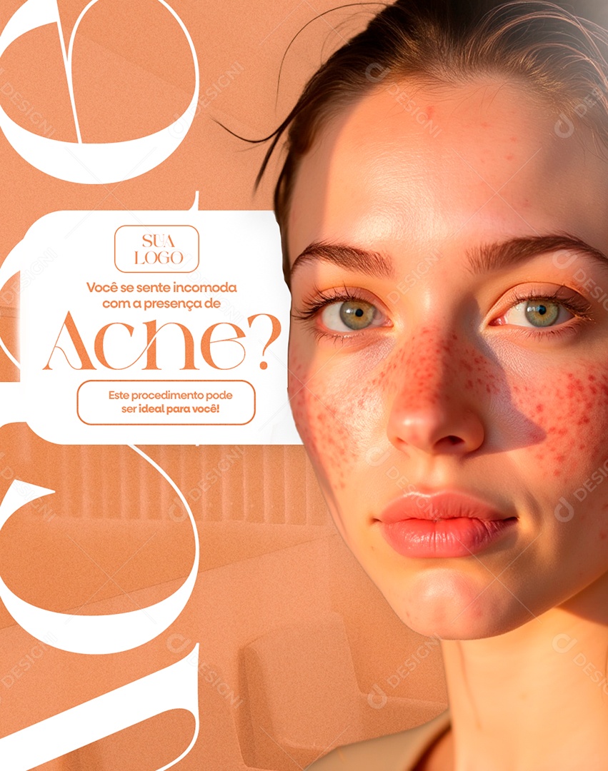 Clínica Estética Acne Social Media PSD Editável