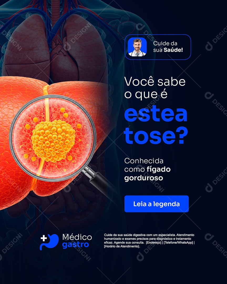 Gastro Você Sabe O Que é Esteatose Social Media PSD Editável