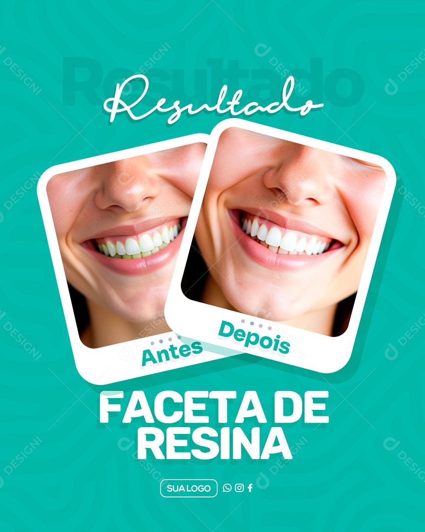 Dentista Faceta de Resina Antes e Depois Social Media PSD Editável