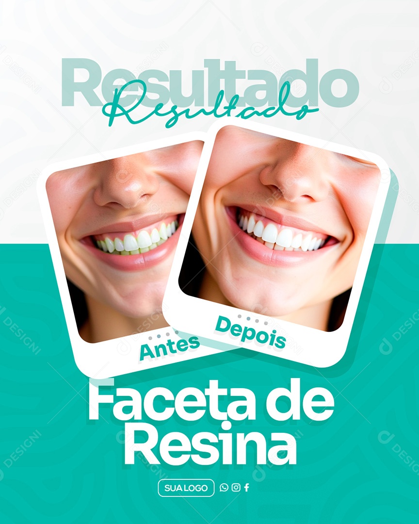 Dentista Faceta de Resina Antes e Depois Social Media PSD Editável