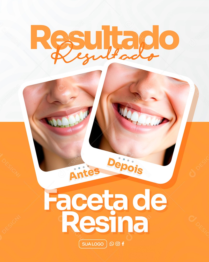 Dentista Faceta de Resina Antes e Depois Social Media PSD Editável