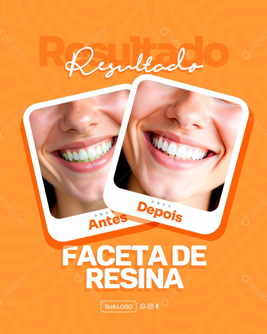 Dentista Faceta de Resina Antes e Depois Social Media PSD Editável