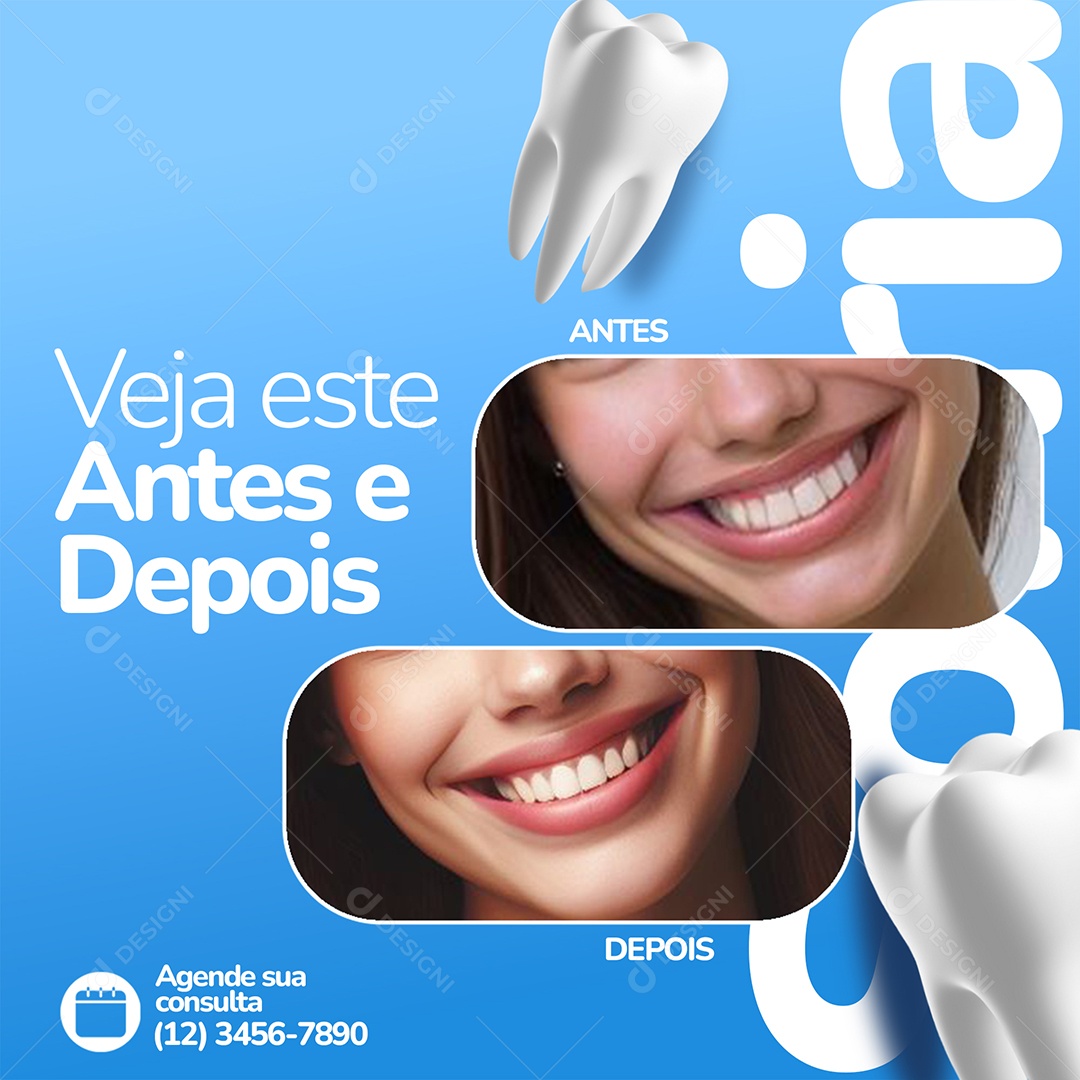 Odonto Veja Esse Antes e Depois Social Media PSD Editável