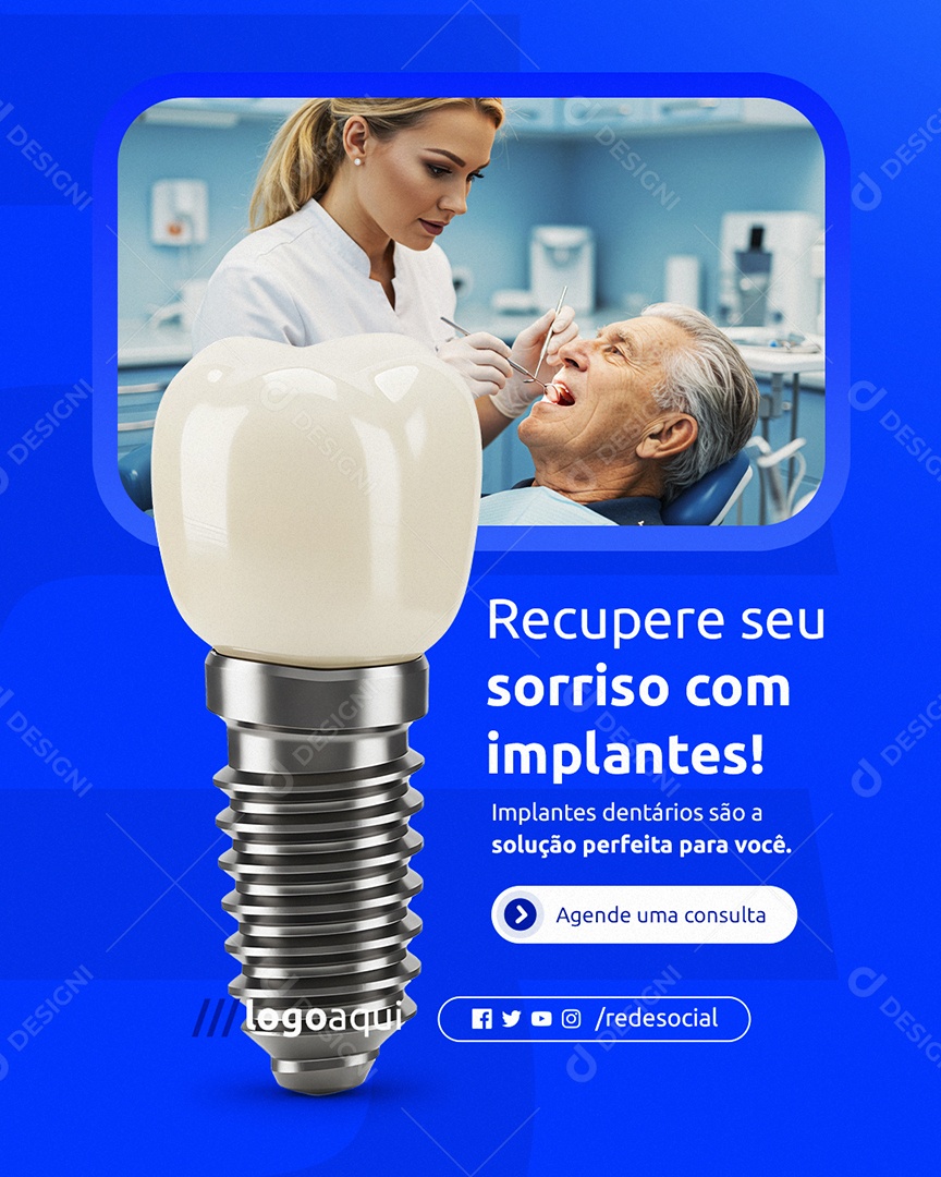 Dentista Recupere seu Sorriso com Implantes Social Media PSD Editável