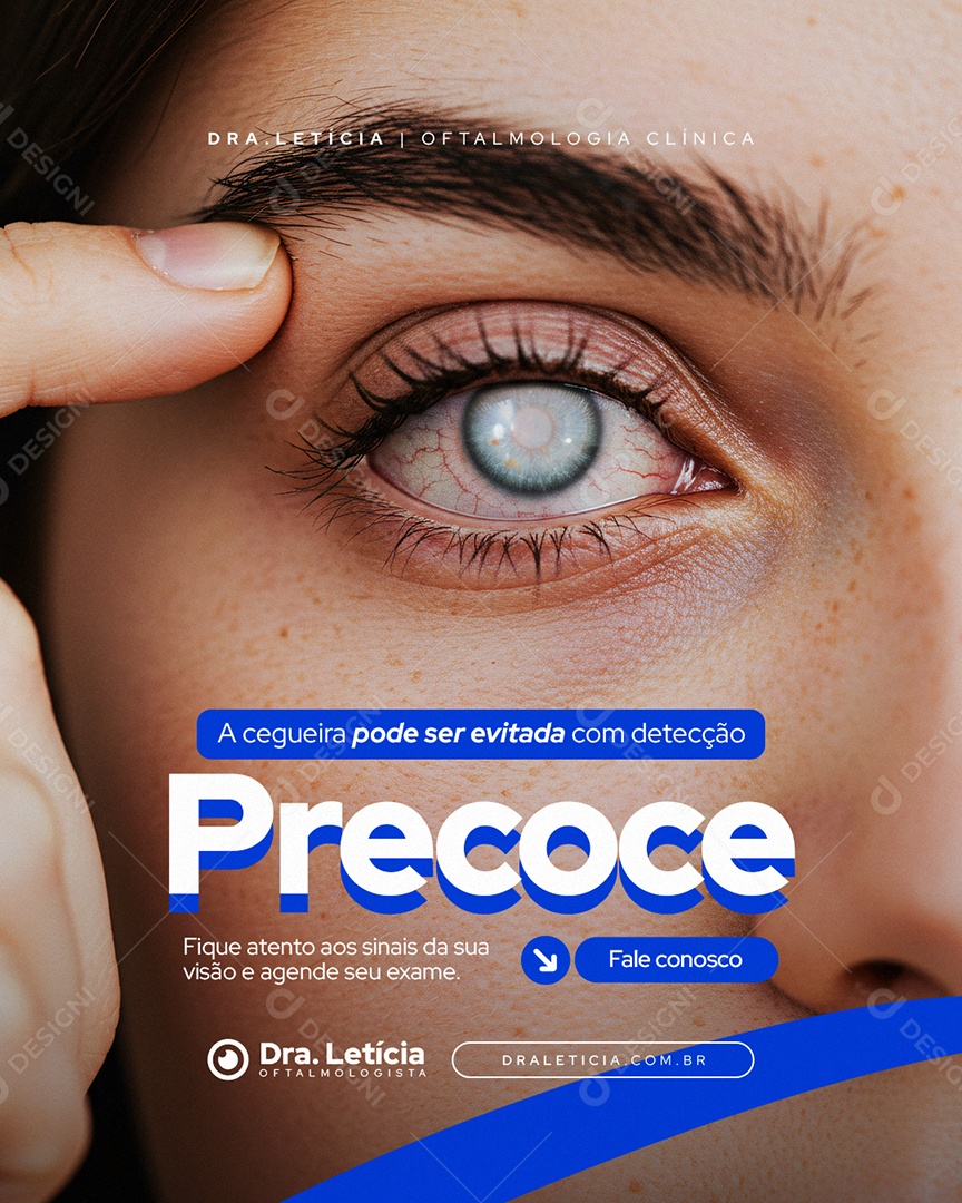 Clínica Oftalmologia A Cegueira Pode Ser Evitada Social Media PSD Editável