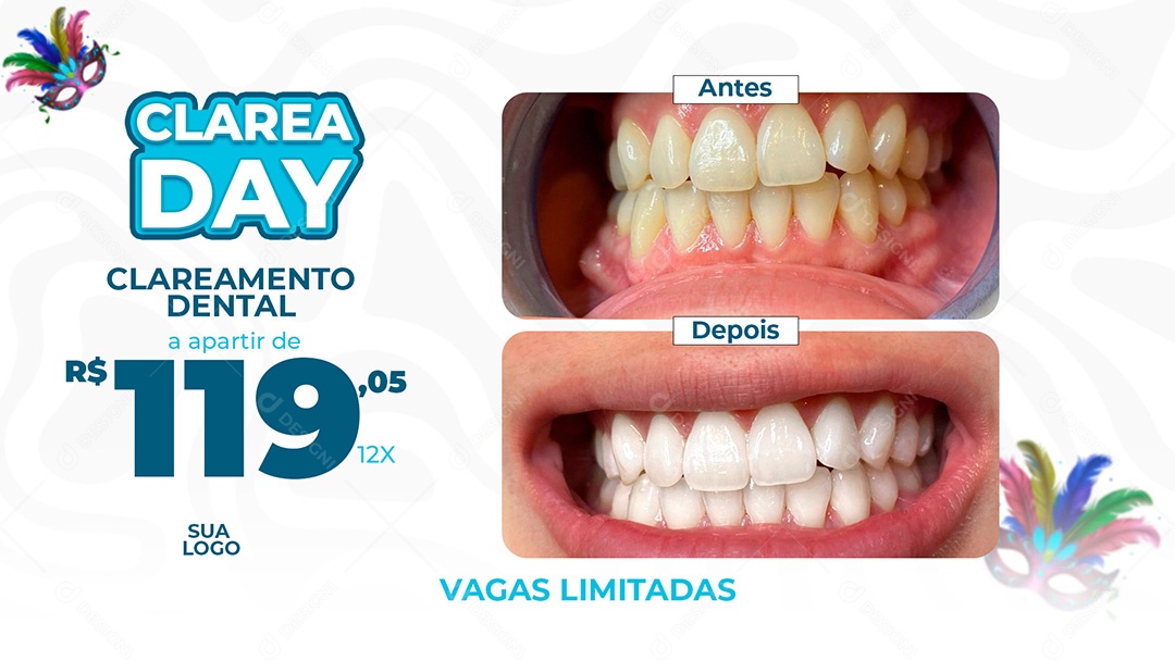 Banner Dentista Clareamento Dental Social Media PSD Editável