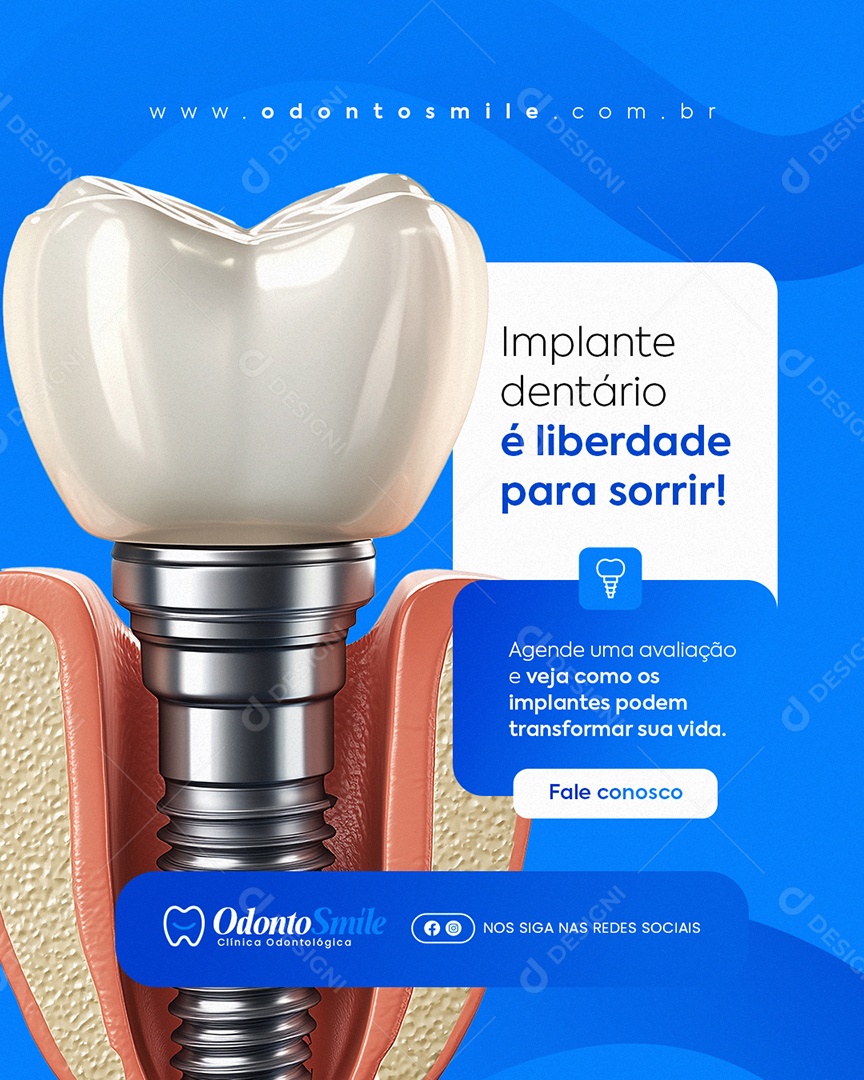 Clínica Odontológica Implante Dentário é Liberdade para Sorrir Social Media PSD Editável