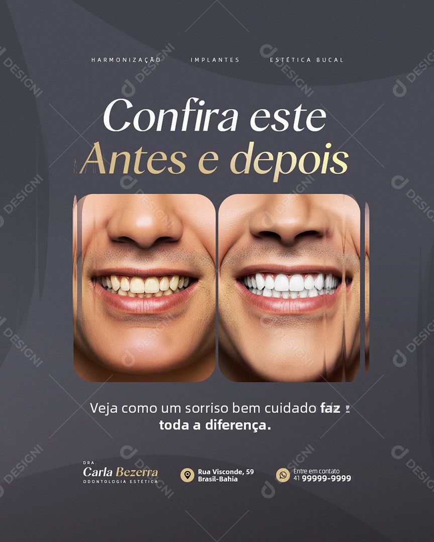 Clínica Odontológica Confira Este Antes e Depois Social Media PSD Editável