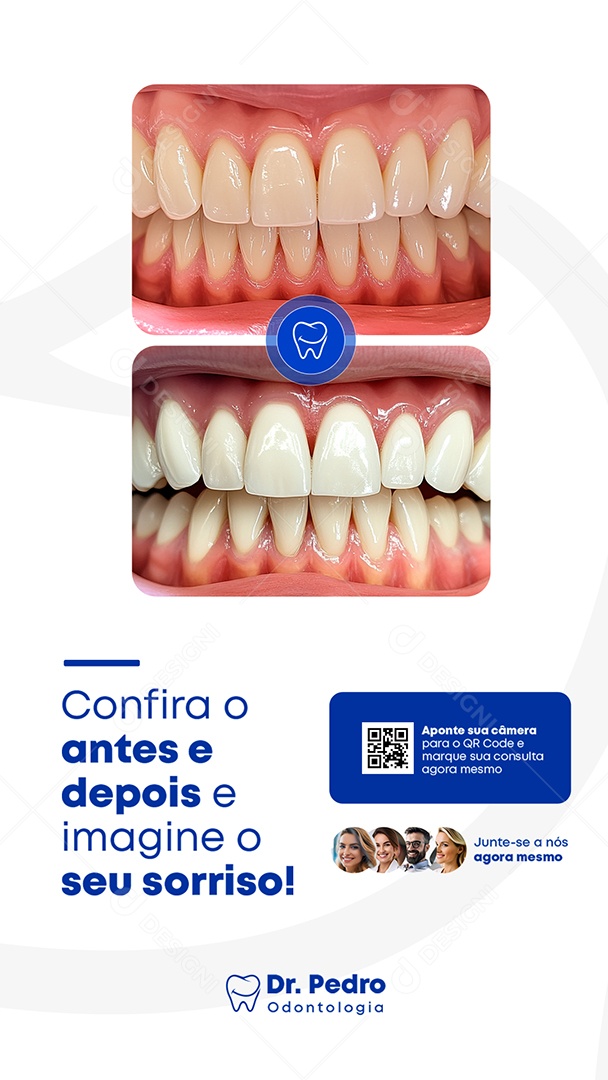 Story Dentista Confira o Antes e Depois Social Media PSD Editável