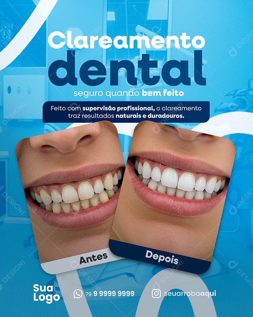 Clareamento Dental Social Media PSD Editável