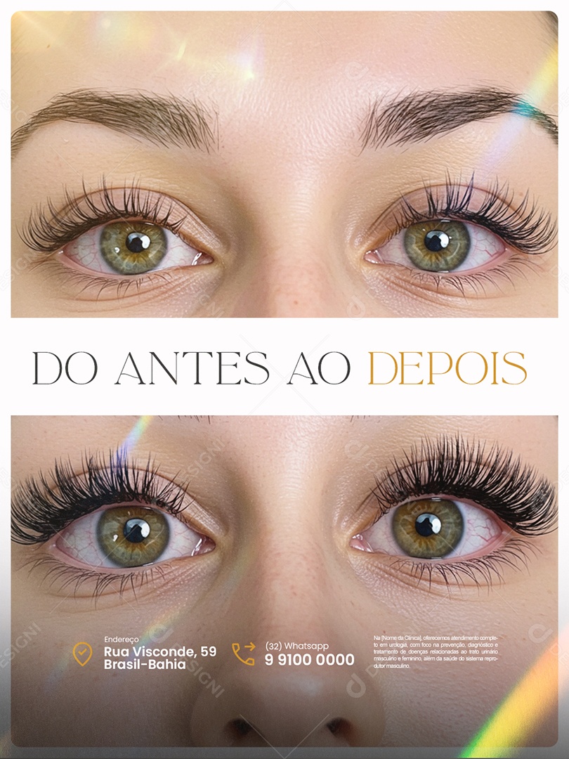 Estética Do Antes ao Depois Social Media PSD Editável