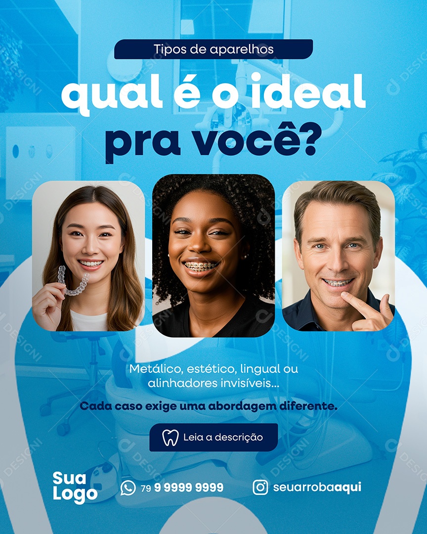Dentista Tipos de Aparelhos qual é o Ideal pra Você Social Media PSD Editável