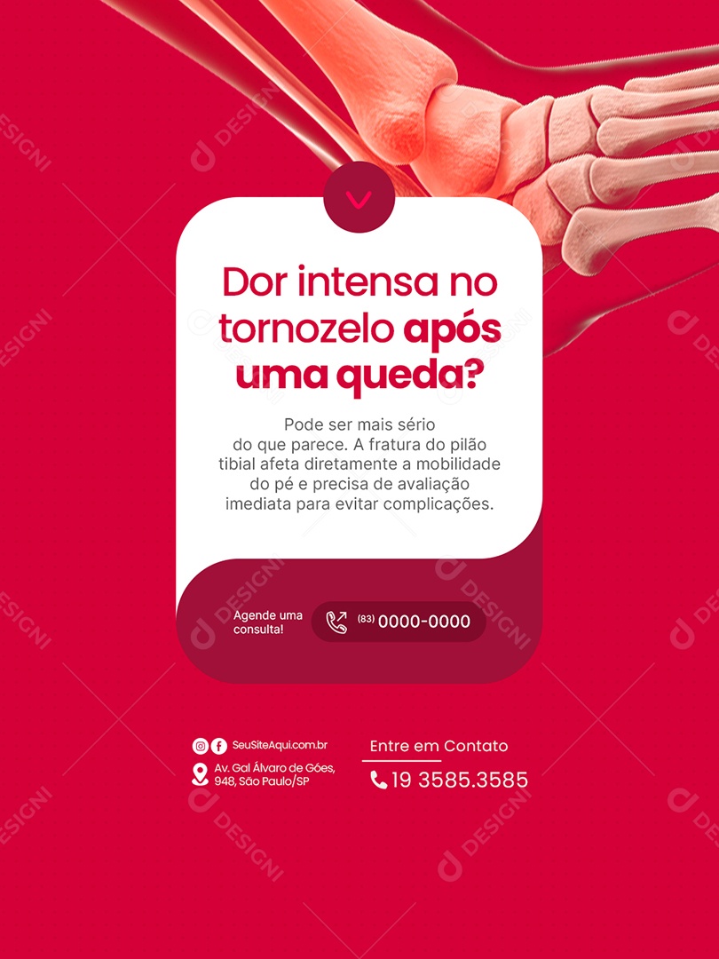 Clínica Ortopédica Dor Intensa no Tornozelo Após Uma Queda Social Media PSD Editável